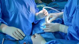 Cholecystectomy