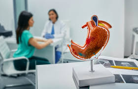 Fundoplication