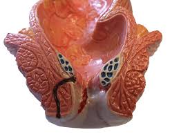 Cholecystectomy