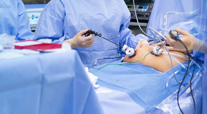 Cholecystectomy